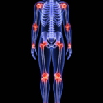 Lire la suite à propos de l’article Arthrose et douleurs articulaires : ce que révèle la lecture énergétique que votre médecin ne vous a jamais faite